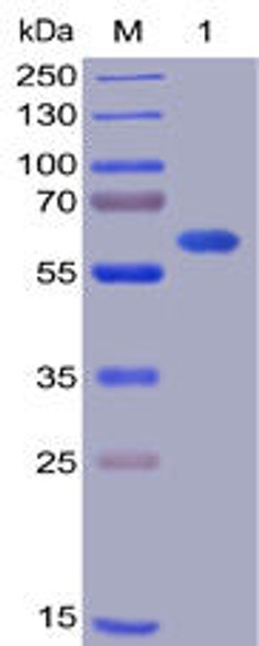 Human OX40L Recombinant Protein (mFc-His Tag) (HDPT0021)
