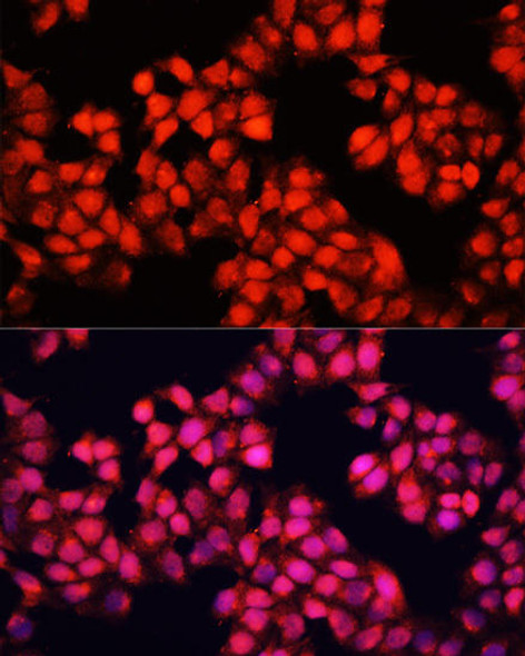 Anti-ALAD Antibody (CAB12395)