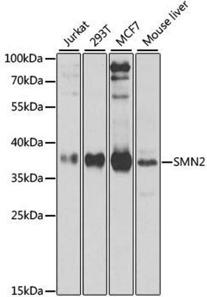 Anti-SMN2 Antibody (CAB12519)