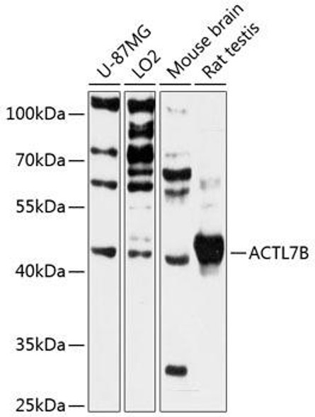 Anti-ACTL7B Antibody (CAB13149)