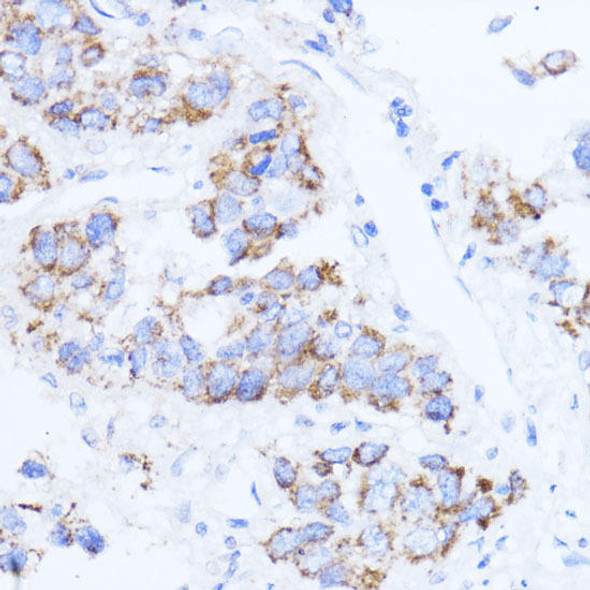 Anti-ACAT1 Antibody (CAB13273)