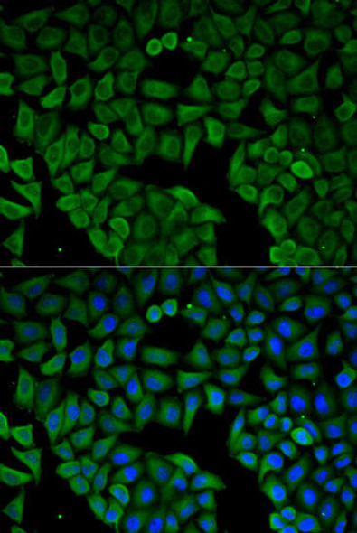 Anti-CHRNA1 Antibody (CAB13287)