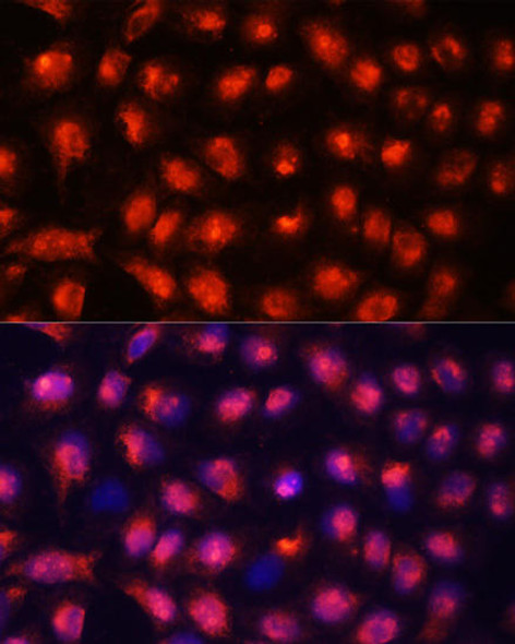 Anti-ACYP1 Antibody (CAB15021)