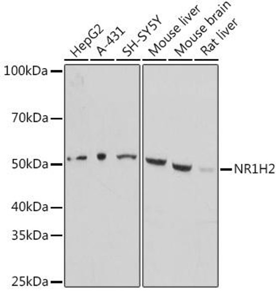 Anti-NR1H2 Antibody (CAB16291)