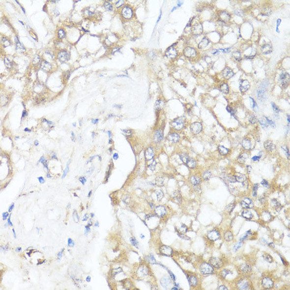 Anti-Smad7 Antibody (CAB16396)