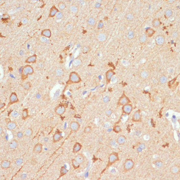 Anti-GRIA1 Antibody (CAB1826)