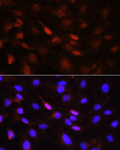 Anti-PLK1 Antibody (CAB2548)