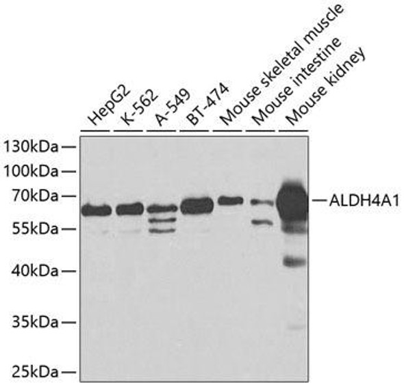 Anti-ALDH4A1 Antibody (CAB2595)