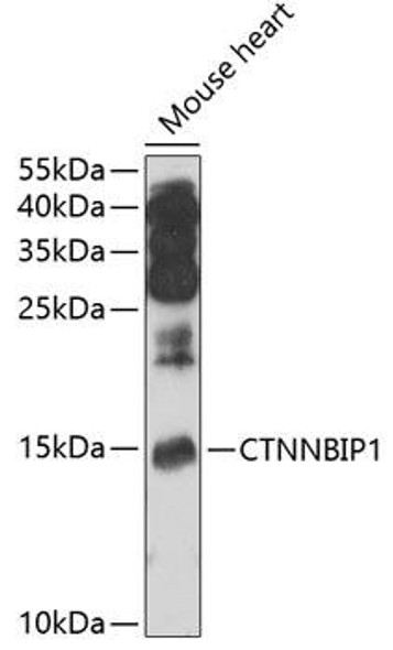 Anti-CTNNBIP1 Antibody (CAB7122)