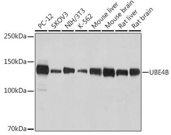 UBE4B Rabbit Monoclonal Antibody (CAB0419)
