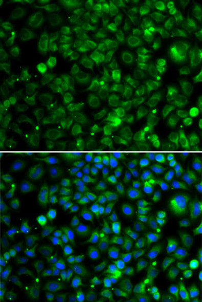 Anti-TMLHE Antibody (CAB7312)