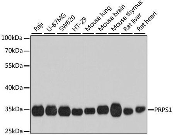 Anti-PRPS1 Antibody (CAB8145)