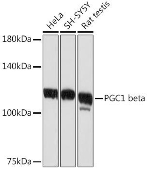 PGC1 beta Rabbit Monoclonal Antibody (CAB4331)