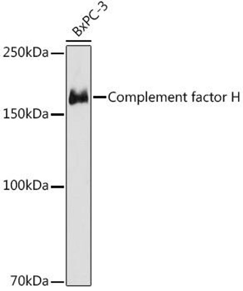 Factor H Rabbit Monoclonal Antibody (CAB8798)