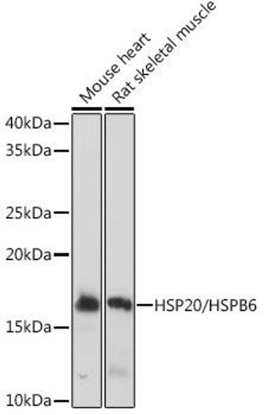 HSP20/HSPB6 Rabbit Monoclonal Antibody (CAB9091)