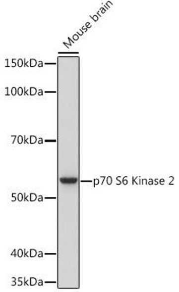 p70 S6 Kinase 2 Rabbit Monoclonal Antibody (CAB9100)