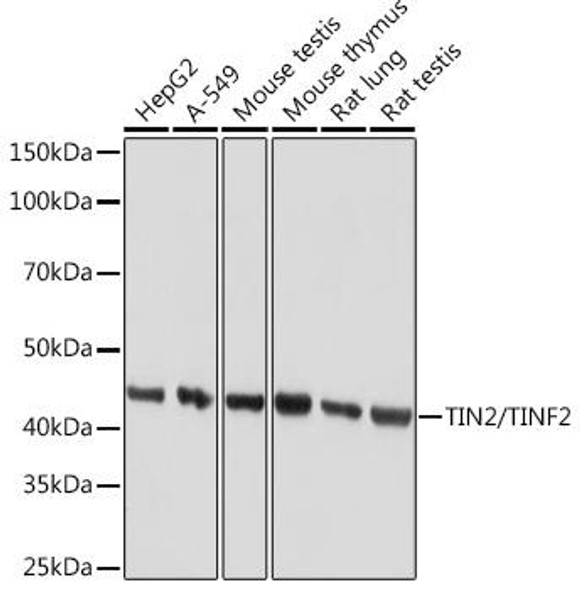 TIN2/TINF2 Rabbit Monoclonal Antibody (CAB9750)