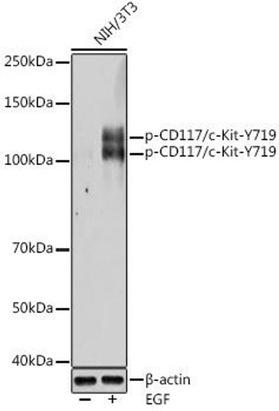 Phospho-KIT-Y719 Rabbit Polyclonal Antibody (CABP0586)
