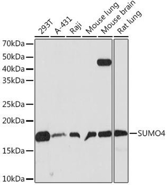 Anti-SUMO4 Antibody (CAB9016)