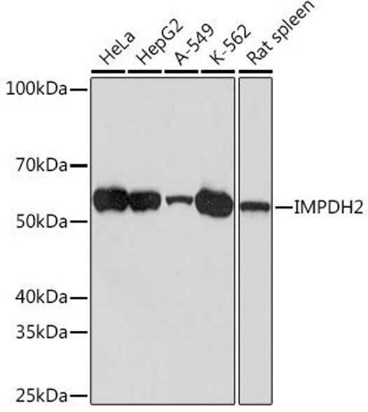 Anti-IMPDH2 Antibody (CAB9208)