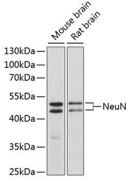 Anti-NeuN Antibody (CAB0951)[KO Validated]