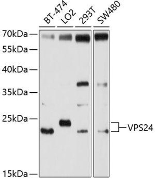 Anti-VPS24 Antibody (CAB10306)