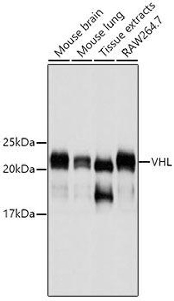 Anti-VHL Mouse Monoclonal Antibody (CAB11872)