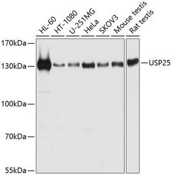 Anti-USP25 Antibody (CAB12588)