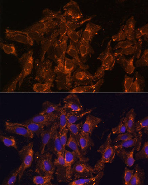 Anti-HSD17B8 Antibody (CAB12947)