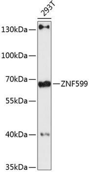 Anti-ZNF599 Antibody (CAB13140)