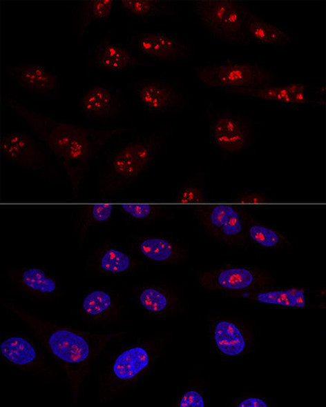 Anti-NOP58 Antibody (CAB14129)