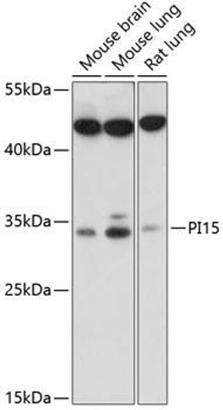 Anti-PI15 Antibody (CAB14886)