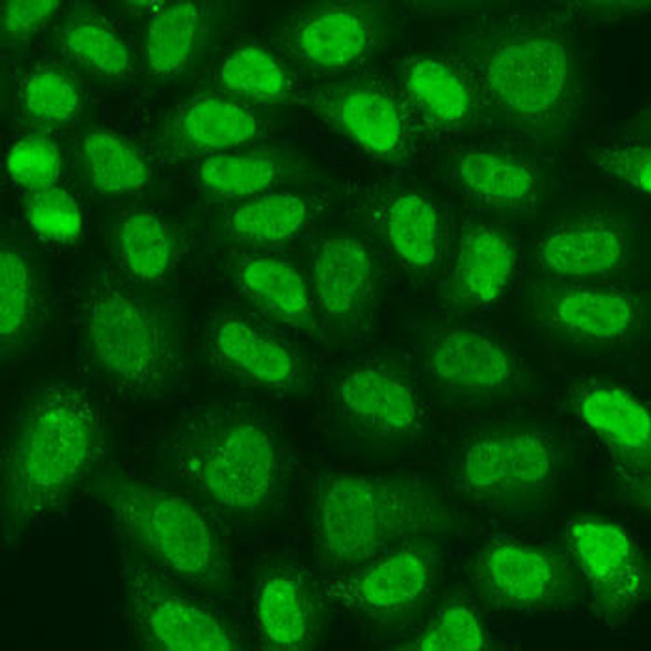 Anti-TERF2IP Antibody (CAB15163)