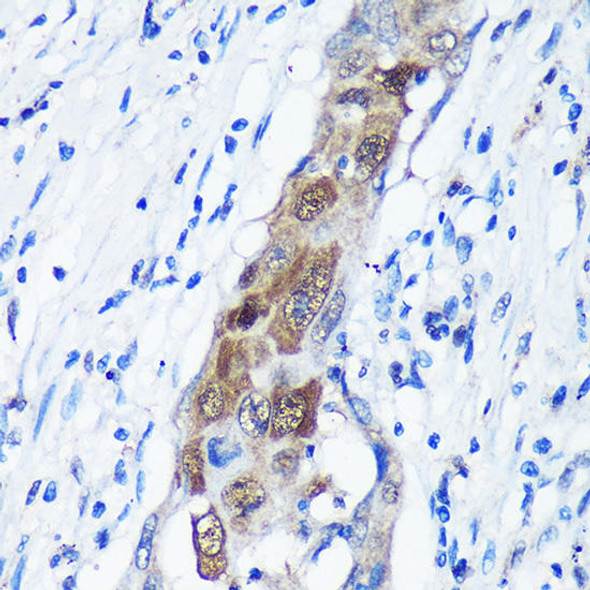 Anti-CAMKK1 Antibody (CAB16716)