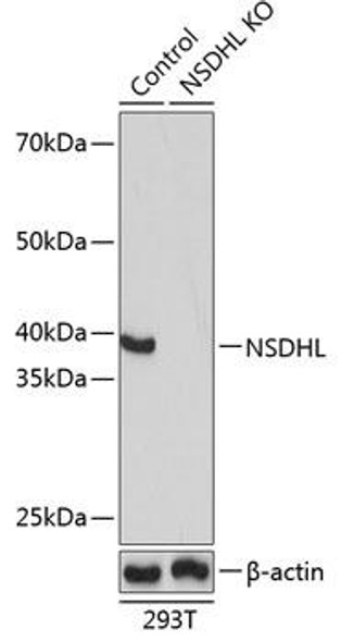 Anti-NSDHL Antibody (CAB16893)[KO Validated]