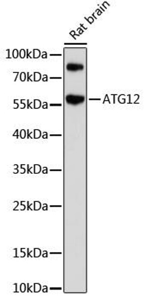 Anti-ATG12 Antibody (CAB17045)