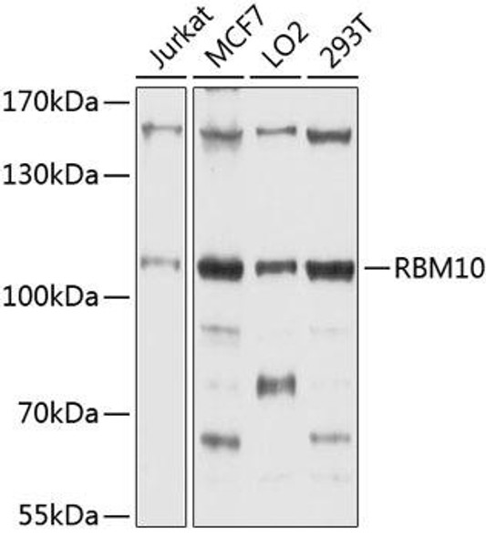 Anti-RBM10 Antibody (CAB4209)