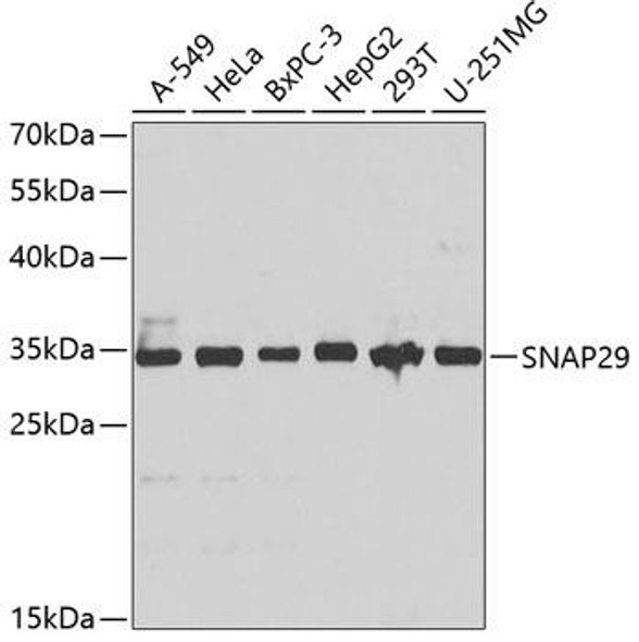 Anti-SNAP29 Antibody (CAB4290)