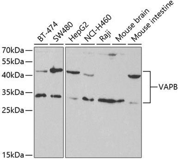 Anti-VAPB Antibody (CAB5363)