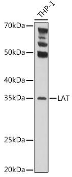 Anti-LAT Antibody (CAB5650)