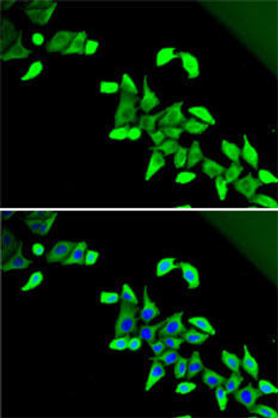 Anti-CDKAL1 Antibody (CAB5771)