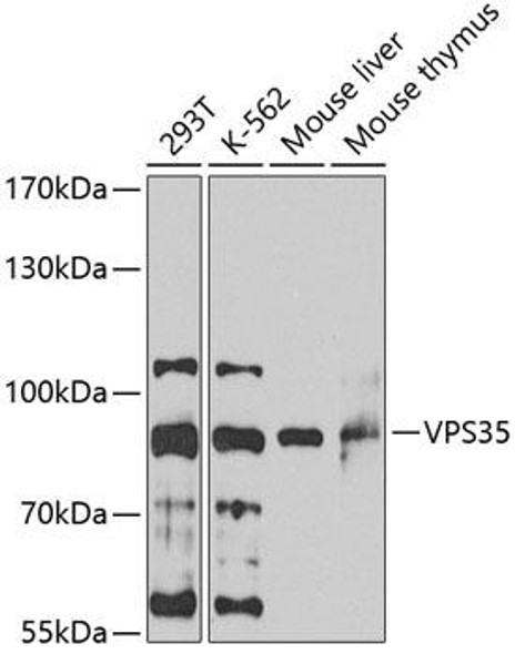 Anti-VPS35 Antibody (CAB7117)