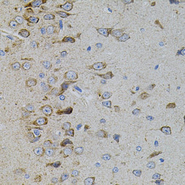 Anti-MAPK11 Antibody (CAB7717)