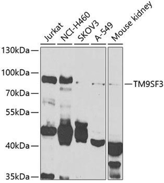 Anti-TM9SF3 Antibody (CAB7819)