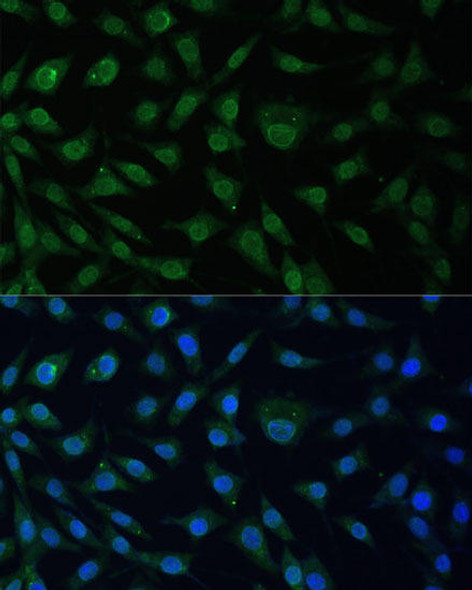 Anti-NUP214 Antibody (CAB8357)