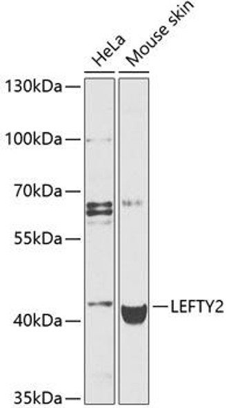 Anti-LEFTY2 Antibody (CAB9846)