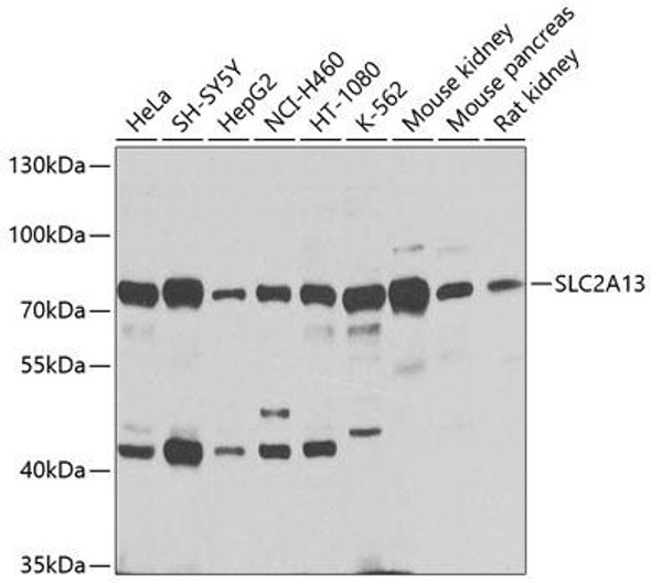 Anti-SLC2A13 Antibody (CAB9993)