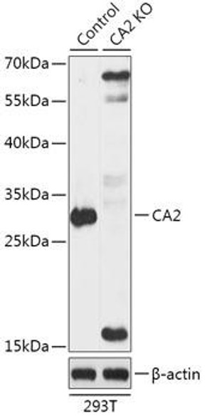 Anti-CA2 Antibody (CAB18034)[KO Validated]