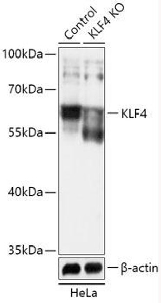Anti-KLF4 Antibody (CAB18088)[KO Validated]