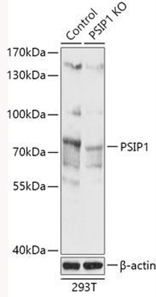 Anti-PSIP1 Antibody (CAB18101)[KO Validated]